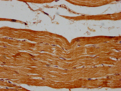 PSMB2 Antibody - IHC image of PSMB2 Antibody diluted at 1:500 and staining in paraffin-embedded human skeletal muscle tissue performed on a Leica BondTM system. After dewaxing and hydration, antigen retrieval was mediated by high pressure in a citrate buffer (pH 6.0). Section was blocked with 10% normal goat serum 30min at RT. Then primary antibody (1% BSA) was incubated at 4°C overnight. The primary is detected by a biotinylated secondary antibody and visualized using an HRP conjugated SP system.