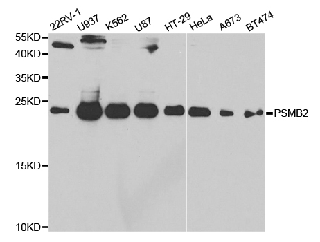 PSMB2 Antibody - Western blot analysis of extracts of various cell lines.