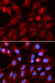 PSMB2 Antibody - Immunofluorescence analysis of U20S cells.