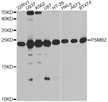 PSMB2 Antibody - Western blot analysis of extracts of various cell lines, using PSMB2 antibody at 1:1000 dilution. The secondary antibody used was an HRP Goat Anti-Rabbit IgG (H+L) at 1:10000 dilution. Lysates were loaded 25ug per lane and 3% nonfat dry milk in TBST was used for blocking. An ECL Kit was used for detection and the exposure time was 15s.
