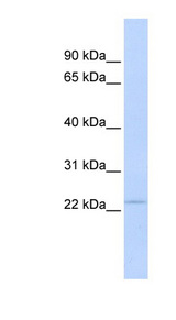 PSMB3 Antibody - PSMB3 antibody Western blot of Fetal Muscle lysate. This image was taken for the unconjugated form of this product. Other forms have not been tested.