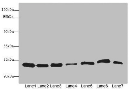PSMB3 Antibody - Western blot All Lanes: PSMB3antibody at 3.73ug/ml Lane 1 : Hela whole cell lysate Lane 2 : MCF7 whole cell lysate Lane 3 : HepG-2 whole cell lysate Lane 4 : K562 whole cell lysate Lane 5 : Jurkat whole cell lysate Lane 6 : NIH/3T3 whole cell lysate Lane 7 : 293T whole cell lysate Secondary Goat polyclonal to Rabbit IgG at 1/10000 dilution Predicted band size: 23 kDa Observed band size: 23 kDa