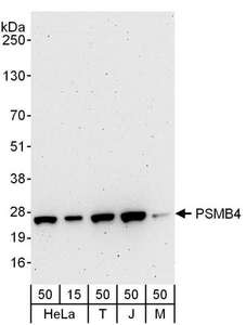 PSMB4 Antibody - Detection of Human and Mouse PSMB4 by Western Blot. Samples: Whole cell lysate from 293T (15 and 50 ug), HeLa (H; 50 ug), Jurkat (J; 50 ug) and mouse NIH3T3 (M; 50 ug) cells. Antibodies: Affinity purified rabbit anti-PSMB4 antibody used for WB at 0.1 ug/ml. Detection: Chemiluminescence with an exposure time of 3 minutes.