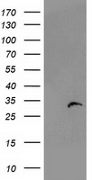 PSMB4 Antibody - HEK293T cells were transfected with the pCMV6-ENTRY control (Left lane) or pCMV6-ENTRY PSMB4 (Right lane) cDNA for 48 hrs and lysed. Equivalent amounts of cell lysates (5 ug per lane) were separated by SDS-PAGE and immunoblotted with anti-PSMB4.