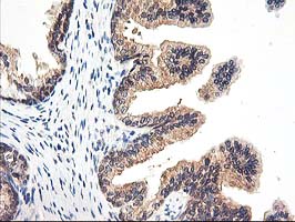 PSMB4 Antibody - IHC of paraffin-embedded Human prostate tissue using anti-PSMB4 mouse monoclonal antibody.