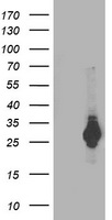 PSMB4 Antibody - HEK293T cells were transfected with the pCMV6-ENTRY control (Left lane) or pCMV6-ENTRY PSMB4 (Right lane) cDNA for 48 hrs and lysed. Equivalent amounts of cell lysates (5 ug per lane) were separated by SDS-PAGE and immunoblotted with anti-PSMB4.