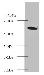 PSMB4 Antibody - Western blot All lanes: Proteasome subunit beta type-4 Antibody at 2µg/ml + EC109 whole cell lysate Secondary Goat polyclonal to rabbit IgG at 1/15000 dilution Predicted band size: 29 kDa Observed band size: 75 kDa