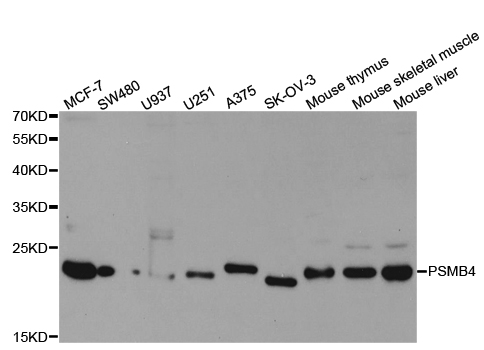 PSMB4 Antibody - Western blot analysis of extracts of various cell lines, using PSMB4 antibody.