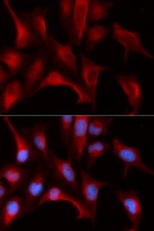 PSMB4 Antibody - Immunofluorescence analysis of U20S cell using PSMB4 antibody. Blue: DAPI for nuclear staining.