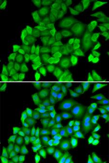 PSMB4 Antibody - Immunofluorescence analysis of MCF-7 cells.