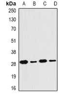 PSMB4 Antibody - Western blot analysis of PSMB4 expression in MCF7 (A); SKOV3 (B); mouse thymus (C); mouse liver (D) whole cell lysates.