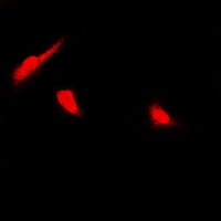 PSMB4 Antibody - Immunofluorescent analysis of PSMB4 staining in U2OS cells. Formalin-fixed cells were permeabilized with 0.1% Triton X-100 in TBS for 5-10 minutes and blocked with 3% BSA-PBS for 30 minutes at room temperature. Cells were probed with the primary antibody in 3% BSA-PBS and incubated overnight at 4 deg C in a humidified chamber. Cells were washed with PBST and incubated with a DyLight 594-conjugated secondary antibody (red) in PBS at room temperature in the dark.