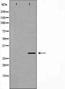 PSMB4 Antibody - Western blot analysis of A431 cell lysates using PSMB4 antibody. The lane on the left is treated with the antigen-specific peptide.