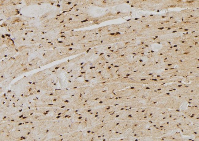 PSMB4 Antibody - 1:100 staining rat heart tissue by IHC-P. The sample was formaldehyde fixed and a heat mediated antigen retrieval step in citrate buffer was performed. The sample was then blocked and incubated with the antibody for 1.5 hours at 22°C. An HRP conjugated goat anti-rabbit antibody was used as the secondary.
