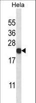 PSMB5 Antibody - PSMB5 Antibody western blot of HeLa cell line lysates (35 ug/lane). The PSMB5 antibody detected the PSMB5 protein (arrow).