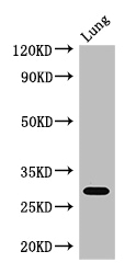 PSMB5 Antibody - Positive WB detected in:Mouse lung tissue;All lanes: PSMB5 antibody at 3ug/ml;Secondary;Goat polyclonal to rabbit IgG at 1/50000 dilution;Predicted band size: 29,22,18 kDa;Observed band size: 29 kDa;