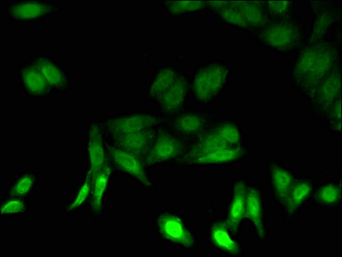 PSMB5 Antibody - Immunofluorescent analysis of HepG2 cells using PSMB5 Antibody at a dilution of 1:100 and Alexa Fluor 488-congugated AffiniPure Goat Anti-Rabbit IgG(H+L)