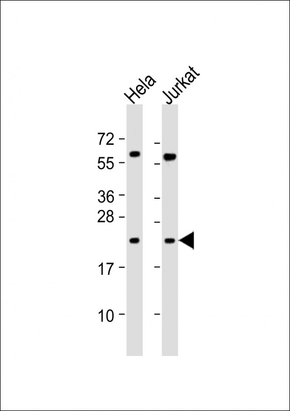 PSMB6 Antibody - All lanes: Anti-PSMB6 Antibody (Center) at 1:2000 dilution. Lane 1: HeLa whole cell lysate. Lane 2: Jurkat whole cell lysate Lysates/proteins at 20 ug per lane. Secondary Goat Anti-Rabbit IgG, (H+L), Peroxidase conjugated at 1:10000 dilution. Predicted band size: 25 kDa. Blocking/Dilution buffer: 5% NFDM/TBST.