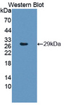 PSMB6 Antibody - Western blot of PSMB6 antibody.