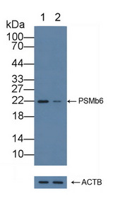 PSMB6 Antibody - Knockout Varification: Lane 1: Wild-type Hela cell lysate; Lane 2: PSMb6 knockout Hela cell lysate; Predicted MW: 25kd Observed MW: 22kd Primary Ab: 1µg/ml Rabbit Anti-Human PSMb6 Antibody Second Ab: 0.2µg/mL HRP-Linked Caprine Anti-Rabbit IgG Polyclonal Antibody