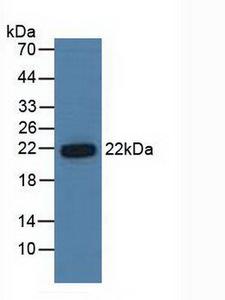 PSMB6 Antibody - Western Blot; Sample: Human Hela Cells.