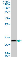 PSMB6 Antibody - PSMB6 monoclonal antibody (M02), clone S51 Western blot of PSMB6 expression in A-431.