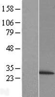 PSMB6 Protein - Western validation with an anti-DDK antibody * L: Control HEK293 lysate R: Over-expression lysate