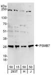 PSMB7 Antibody - Detection of Human PSMB7 by Western Blot. Samples: Whole cell lysate from 293T (15 and 50 ug), HeLa (H; 50 ug), and Jurkat (J; 50 ug) cells. Antibodies: Affinity purified rabbit anti-PSMB7 antibody used for WB at 0.1 ug/ml. Detection: Chemiluminescence with an exposure time of 3 minutes.