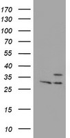 PSMB7 Antibody - HEK293T cells were transfected with the pCMV6-ENTRY control (Left lane) or pCMV6-ENTRY PSMB7 (Right lane) cDNA for 48 hrs and lysed. Equivalent amounts of cell lysates (5 ug per lane) were separated by SDS-PAGE and immunoblotted with anti-PSMB7.