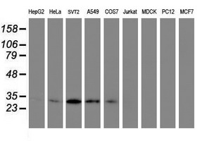 PSMB7 Antibody - Western blot of extracts (35ug) from 9 different cell lines by using anti-PSMB7 monoclonal antibody.