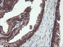 PSMB7 Antibody - IHC of paraffin-embedded Human prostate tissue using anti-PSMB7 mouse monoclonal antibody. (Heat-induced epitope retrieval by 10mM citric buffer, pH6.0, 100C for 10min).