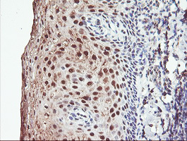 PSMB7 Antibody - IHC of paraffin-embedded Human tonsil using anti-PSMB7 mouse monoclonal antibody. (Heat-induced epitope retrieval by 10mM citric buffer, pH6.0, 100C for 10min).