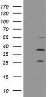 PSMB7 Antibody - HEK293T cells were transfected with the pCMV6-ENTRY control (Left lane) or pCMV6-ENTRY PSMB7 (Right lane) cDNA for 48 hrs and lysed. Equivalent amounts of cell lysates (5 ug per lane) were separated by SDS-PAGE and immunoblotted with anti-PSMB7.