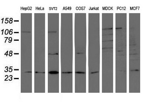 PSMB7 Antibody - Western blot of extracts (35ug) from 9 different cell lines by using anti-PSMB7 monoclonal antibody.