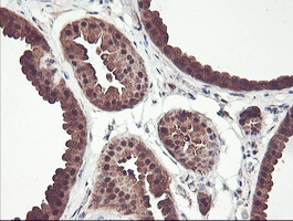 PSMB7 Antibody - IHC of paraffin-embedded Human breast tissue using anti-PSMB7 mouse monoclonal antibody. (Heat-induced epitope retrieval by 10mM citric buffer, pH6.0, 100C for 10min).