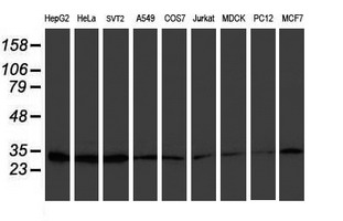 PSMB7 Antibody - Western blot of extracts (35 ug) from 9 different cell lines by using anti-PSMB7 monoclonal antibody.