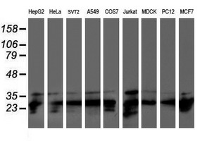 PSMB7 Antibody - Western blot of extracts (35ug) from 9 different cell lines by using anti-PSMB7 monoclonal antibody.