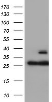 PSMB7 Antibody - HEK293T cells were transfected with the pCMV6-ENTRY control (Left lane) or pCMV6-ENTRY PSMB7 (Right lane) cDNA for 48 hrs and lysed. Equivalent amounts of cell lysates (5 ug per lane) were separated by SDS-PAGE and immunoblotted with anti-PSMB7.