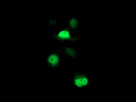 PSMB7 Antibody - Anti-PSMB7 mouse monoclonal antibody immunofluorescent staining of COS7 cells transiently transfected by pCMV6-ENTRY PSMB7.