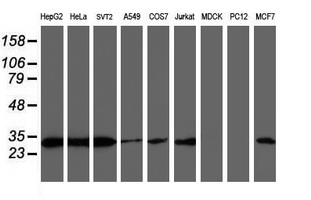 PSMB7 Antibody - Western blot of extracts (35ug) from 9 different cell lines by using anti-PSMB7 monoclonal antibody.