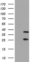 PSMB7 Antibody - HEK293T cells were transfected with the pCMV6-ENTRY control (Left lane) or pCMV6-ENTRY PSMB7 (Right lane) cDNA for 48 hrs and lysed. Equivalent amounts of cell lysates (5 ug per lane) were separated by SDS-PAGE and immunoblotted with anti-PSMB7.