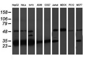PSMB7 Antibody - Western blot of extracts (35 ug) from 9 different cell lines by using anti-PSMB7 monoclonal antibody.