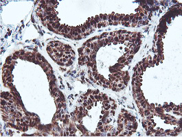 PSMB7 Antibody - IHC of paraffin-embedded Human breast tissue using anti-PSMB7 mouse monoclonal antibody.