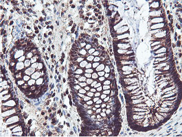 PSMB7 Antibody - IHC of paraffin-embedded Human colon tissue using anti-PSMB7 mouse monoclonal antibody.