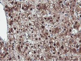 PSMB7 Antibody - IHC of paraffin-embedded Human liver tissue using anti-PSMB7 mouse monoclonal antibody.