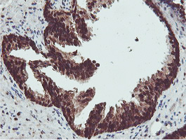 PSMB7 Antibody - IHC of paraffin-embedded Human prostate tissue using anti-PSMB7 mouse monoclonal antibody.