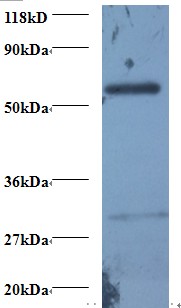 PSMB7 Antibody - Western blot of Proteasome subunit beta type-7 antibody at 2 ug/ml + 293T whole cell lysate. Secondary: Goat polyclonal to Rabbit IgG at 1:15000 dilution. Predicted band size: 30.5 kDa. Observed band size: 30.5 kDa Additional bands at: 60 kDa. We are unsure as to the identity of this extra band.  This image was taken for the unconjugated form of this product. Other forms have not been tested.