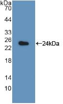 PSMB8 / LMP7 Antibody - Western Blot; Sample: Recombinant LMP7, Rat.