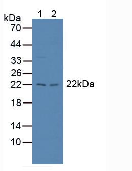 PSMB8 / LMP7 Antibody - Western Blot; Sample: Lane1: Rat Liver Tissue; Lane2: Rat Spleen Tissue.