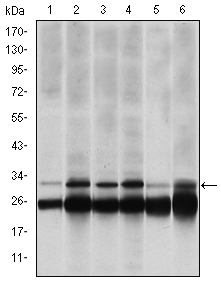 PSMB8 / LMP7 Antibody - Western blot using PSMB8 mouse monoclonal antibody against HeLa (1), MCF-7 (2), A431 (3), RAJI (4), MOTL4 (5) and PC-12 (6) cell lysate.
